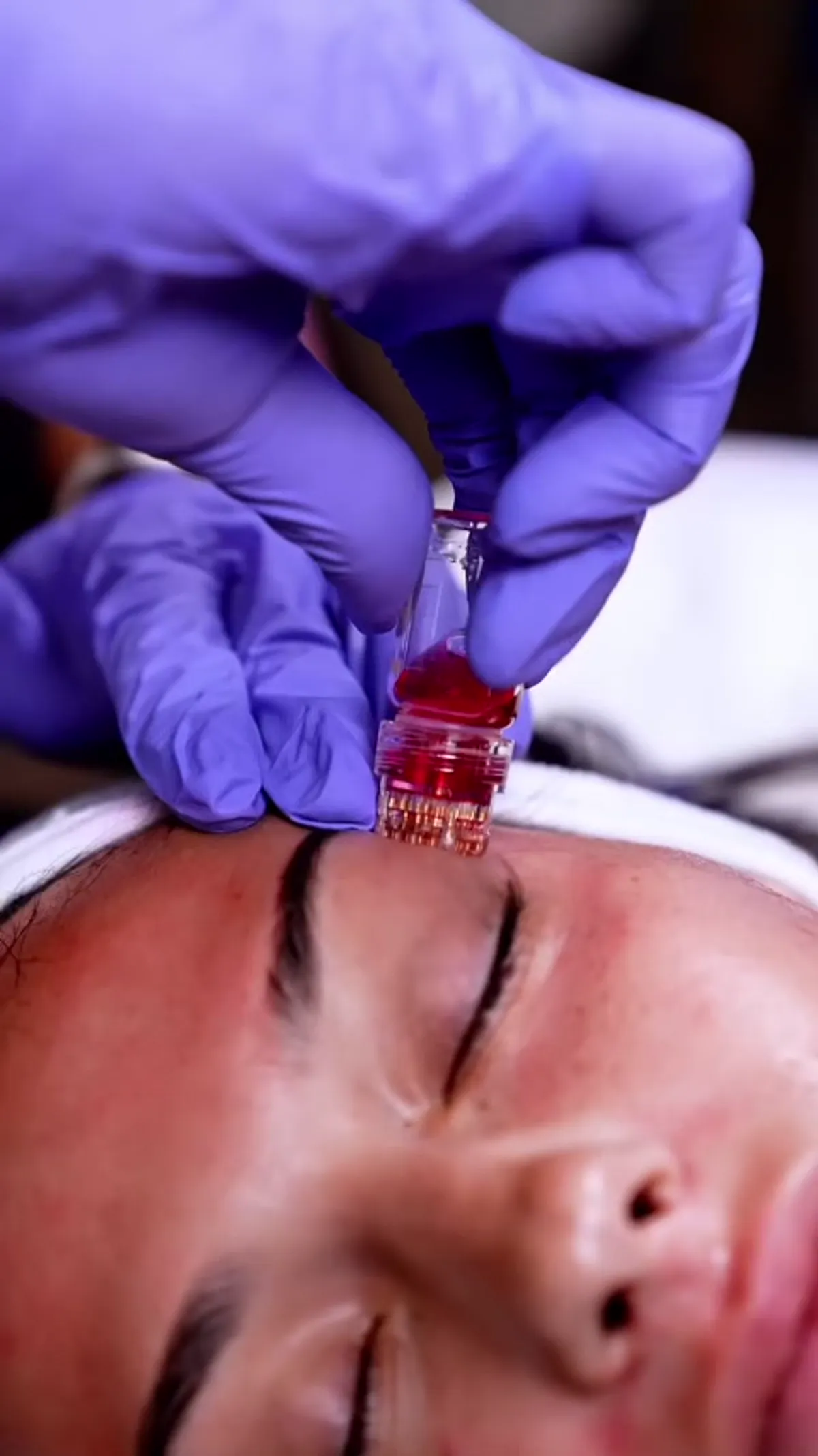 ZO Skin Centre Dallas treatment detail