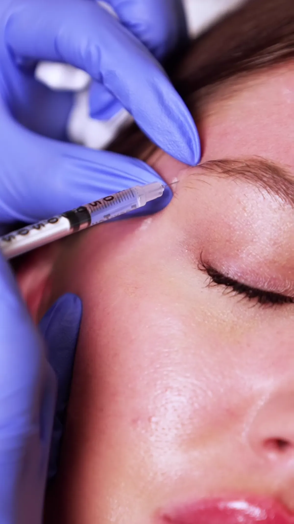 BOTOX® treatment detail
