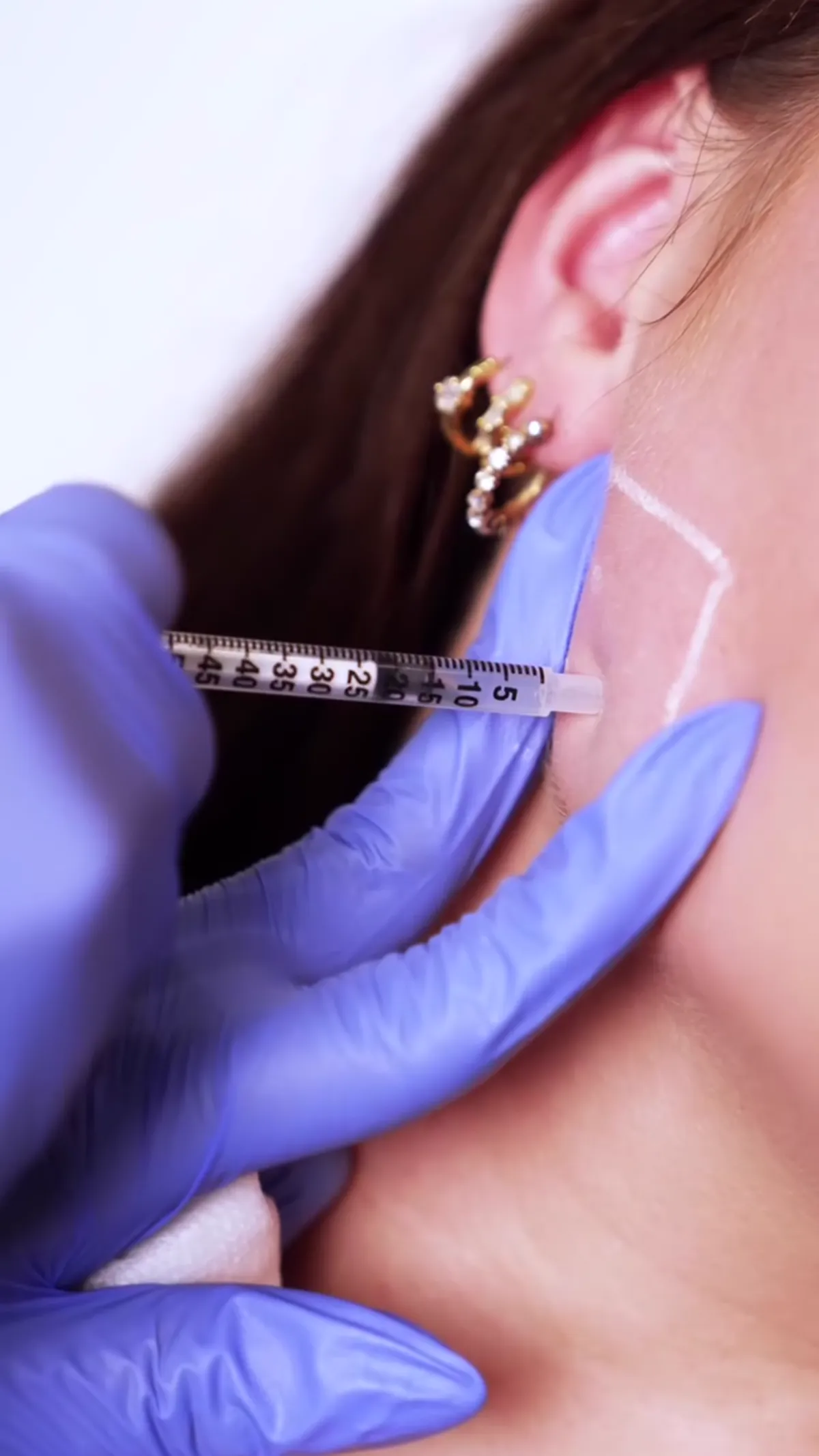 ZO Skin Centre Dallas treatment detail