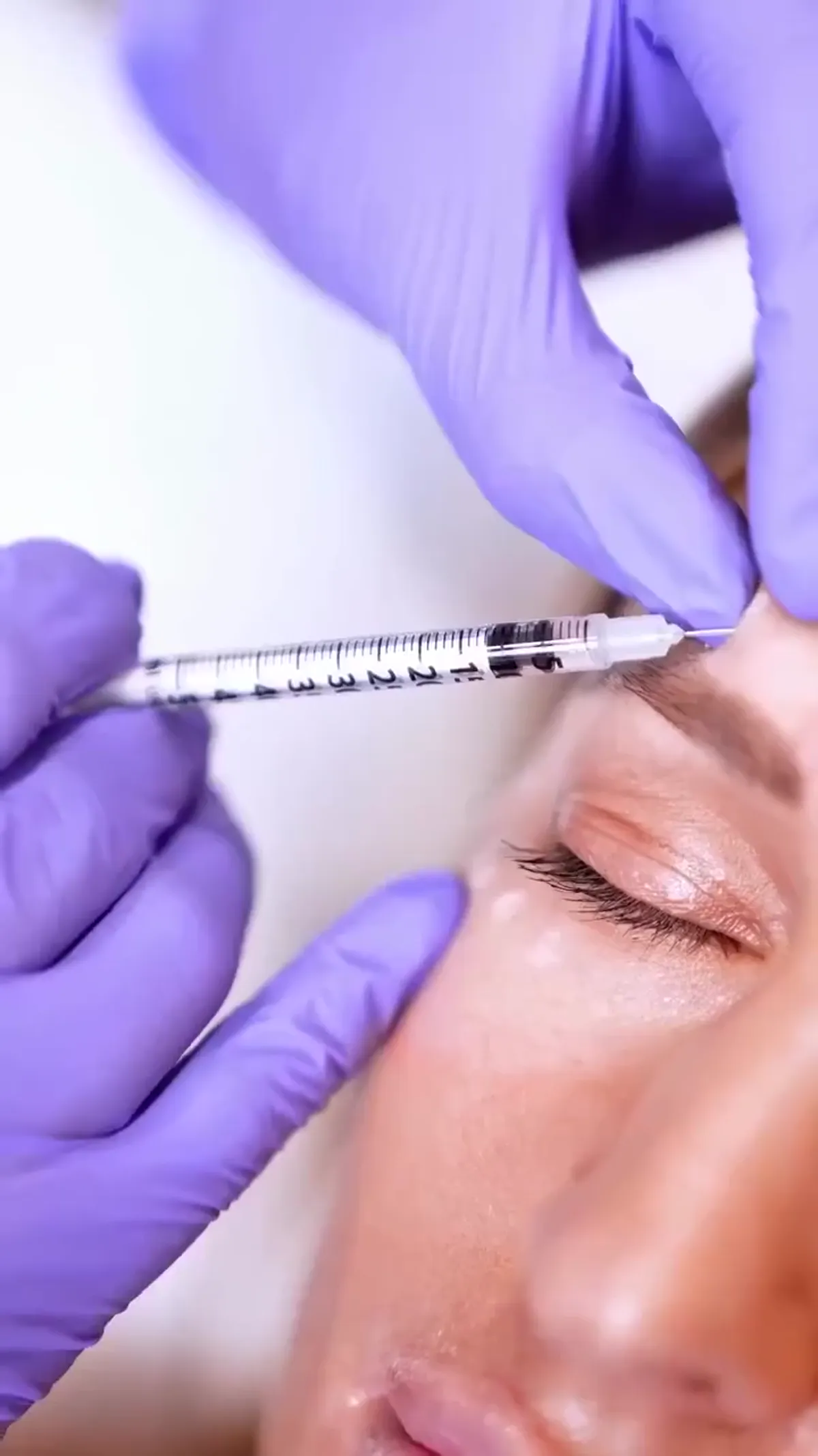 Dysport® treatment
