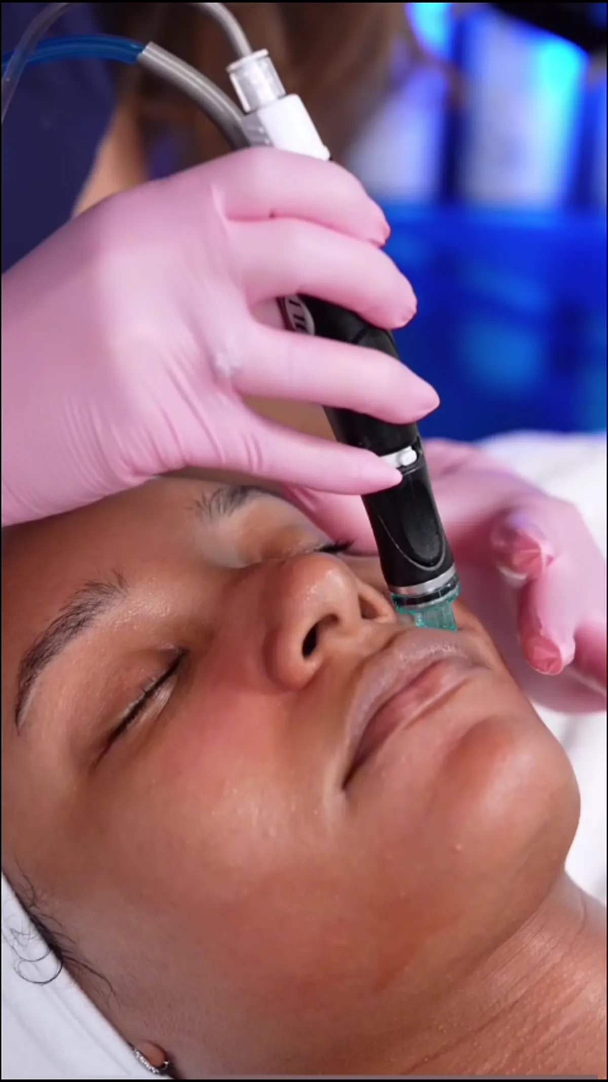 Facials treatment