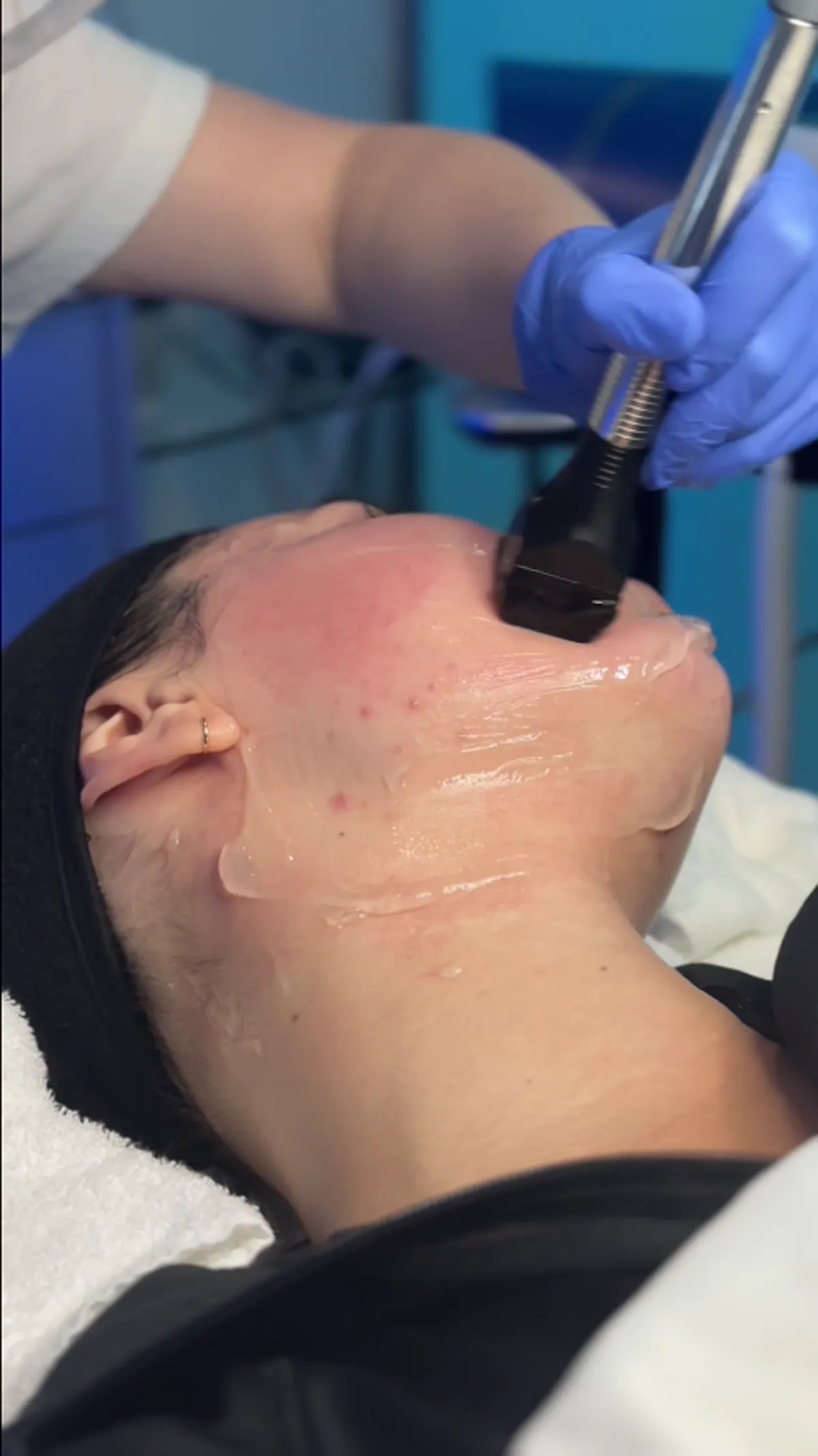 ZO Skin Centre Dallas treatment detail