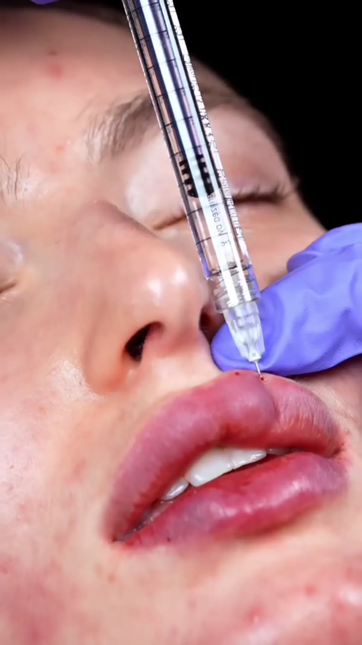 ZO Skin Centre Dallas treatment detail