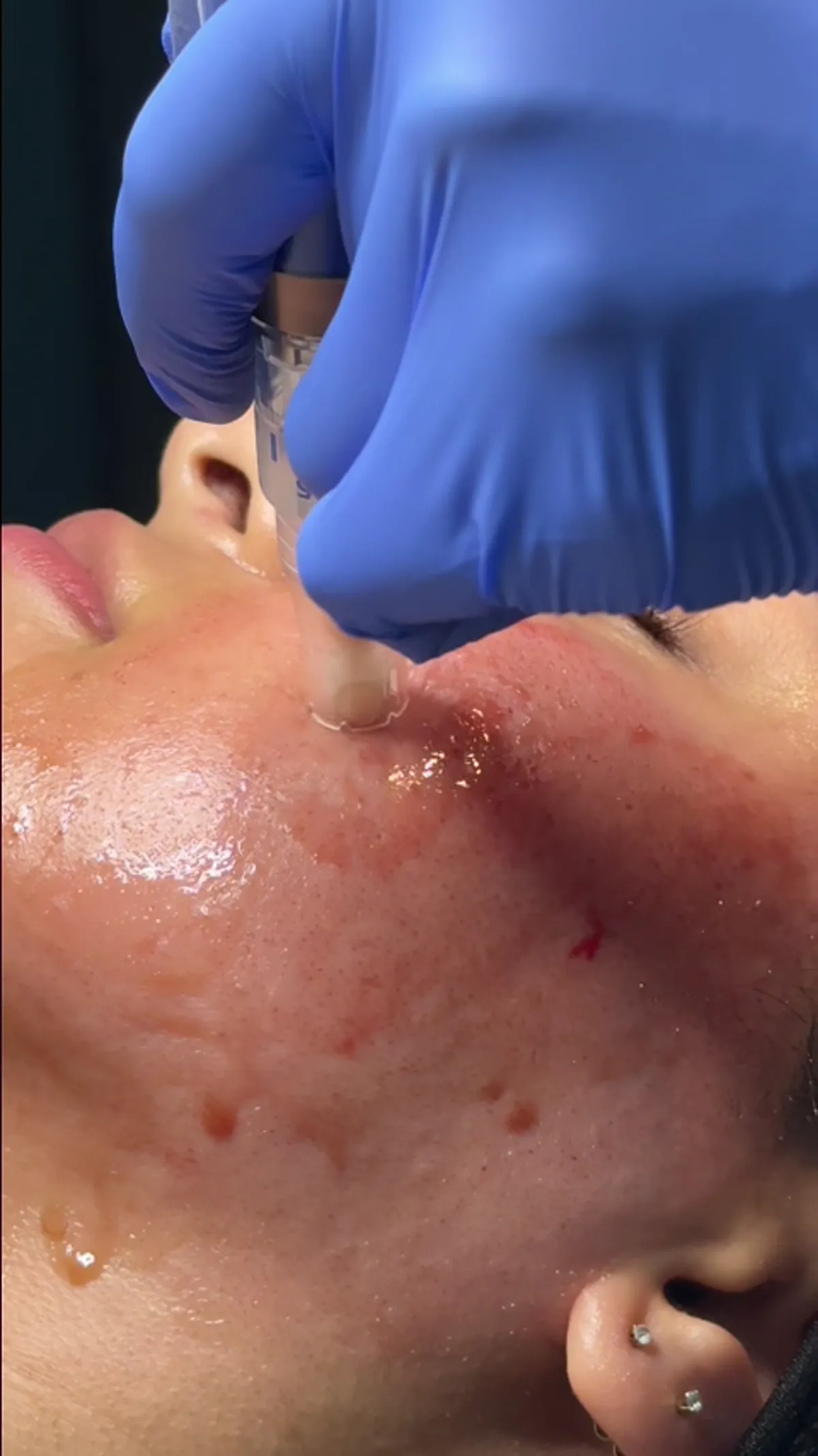 ZO Skin Centre Dallas treatment detail