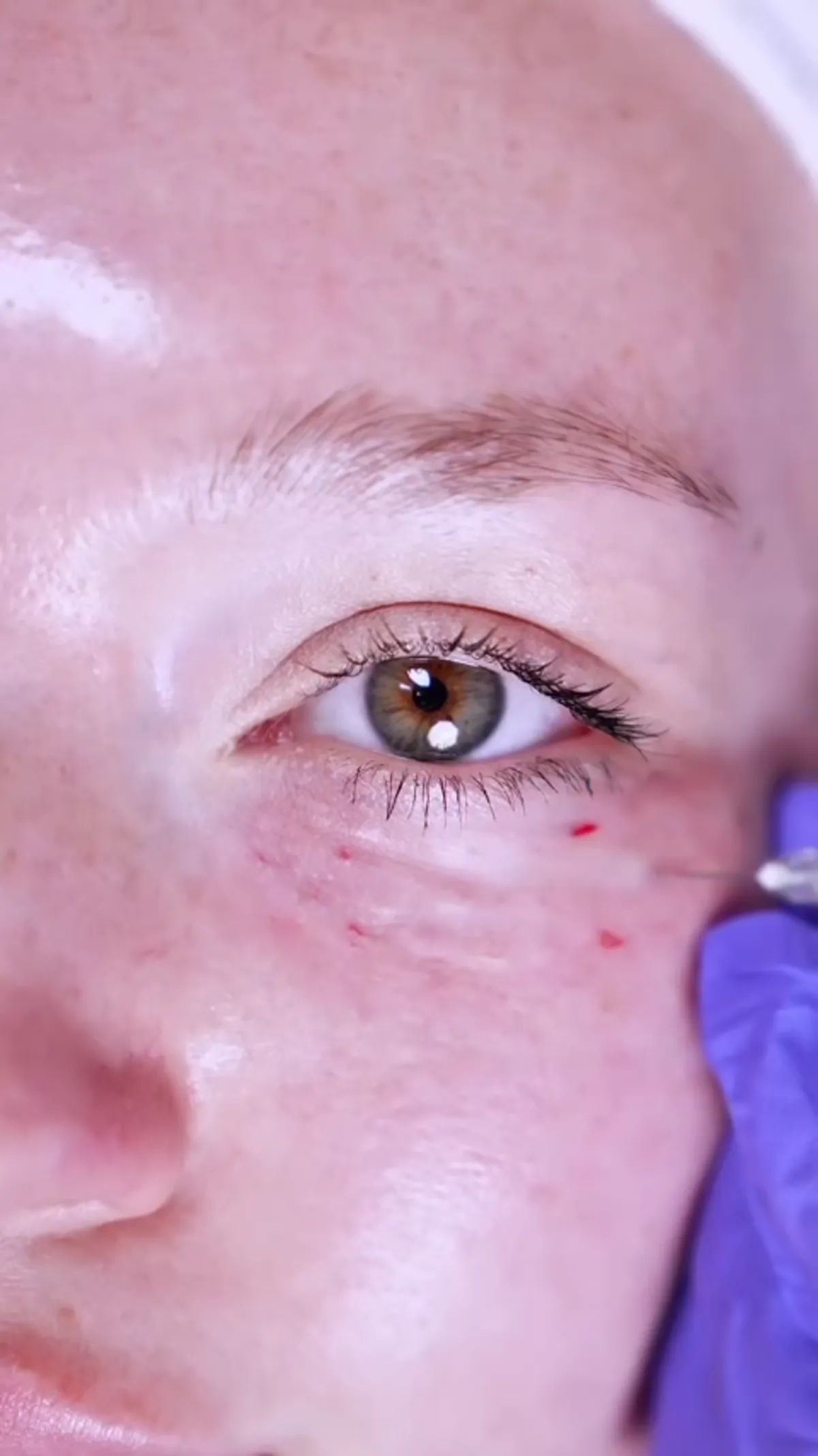 ZO Skin Centre Dallas treatment detail