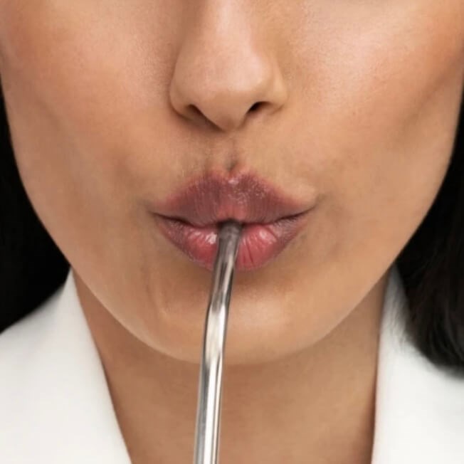 What are perioral lines?