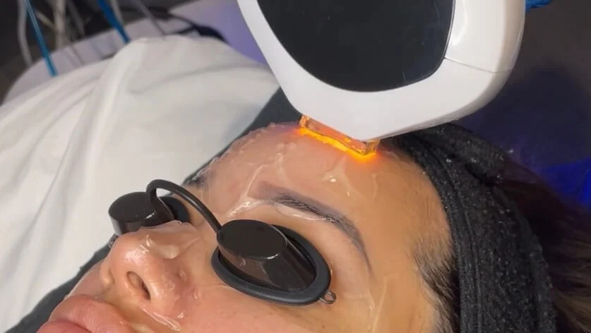 HydraIPL: A safe and simple way to rejuvenate your skin